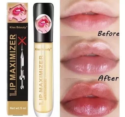 Voluminizador Labios